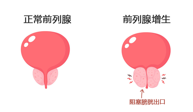 夜尿多不是小事!需警惕4种疾病